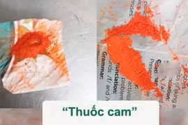 Trẻ ngộ độc chì sau 7 ngày bôi, uống thuốc cam chữa viêm da