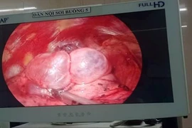 Làm chủ phẫu thuật cắt kén khí phổi ngay tại Ninh Bình