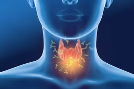 Nhiều loại viêm tuyến giáp ảnh hưởng nghiêm trọng sức khỏe