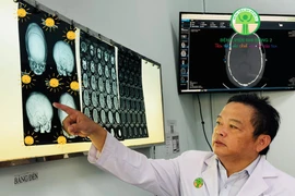 Tạo hình cho trẻ méo đầu do dính khớp sọ