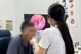 Xương cá dài 4,5 cm cắm sâu vào hạ họng người đàn ông 60 tuổi