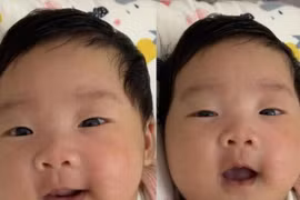 Hành trình giữ thai nguy cơ sinh non từ tuần 26 đến tuần 39