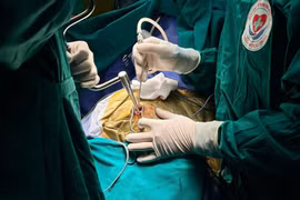 Báo động đỏ liên viện, cứu cụ ông 75 tuổi chấn thương sọ não