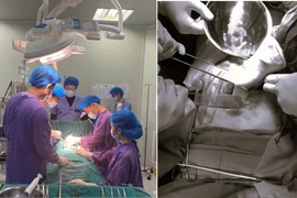 Ngã từ độ cao 4m vào thanh sắt khi dọn nhà đón tết, người bệnh nguy kịch