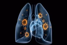 Chủ động bảo vệ sức khỏe hô hấp từ những thói quen nhỏ