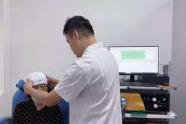 Điều trị rối loạn tiền đình bằng kích thích từ trường xuyên sọ