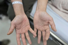 Chơi bóng cười cho vui, hai vợ chồng liệt nửa người 