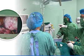 Ra máu âm đạo, người phụ nữ 46 tuổi không ngờ u xơ tử cung biến chứng