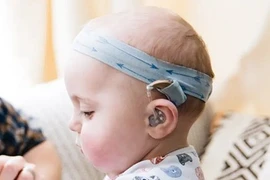 Nghe kém ở trẻ, nhận thức sớm tránh mất cơ hội vàng điều trị