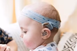 Nghe kém ở trẻ, nhận thức sớm tránh mất cơ hội vàng điều trị