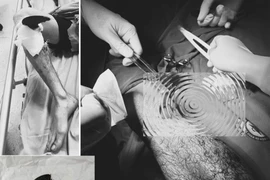 Hướng dẫn xử lý tai nạn lao động đúng cách để bảo vệ chi thể