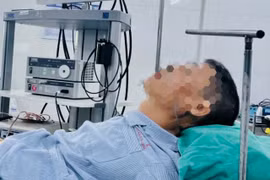 Gây tê tủy sống cho bệnh nhân cột sống cong gù