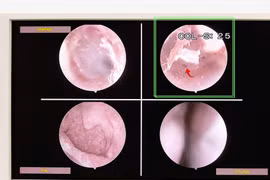 Phát hiện bọ chét sống trong tai bé 2 tuổi, bác sĩ cảnh báo nguy cơ từ thú cưng