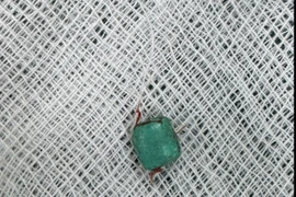 Dị vật bít kín hoàn toàn ống tai trẻ 10 tuổi