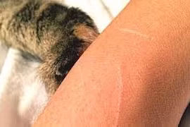 Rét lạnh, sốt cao người đàn ông 71 tuổi tử vong vì bệnh dại do mèo cào