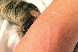 Rét lạnh, sốt cao người đàn ông 71 tuổi tử vong vì bệnh dại do mèo cào