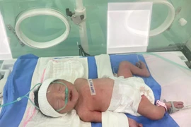 Chạy đua với tử thần cứu sống sản phụ và thai nhi 34 tuần, rau bong non