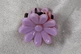 Xử trí dị vật bất thường đường âm đạo cho bé gái 8 tuổi 