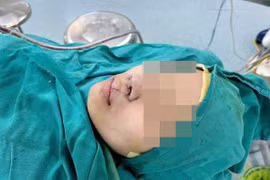 Mổ lần 3 tìm lại nụ cười cho hai chị em bị dị tật khe hở môi mũi bẩm sinh