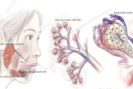 Địa chỉ vàng: Bệnh viện điều trị u tuyến nước bọt