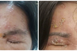 View - Tự tay ngâm rượu trái cây mùa hè, lợi đủ đường | Báo Tri thức và Cuộc sống - TIN TỨC PHỔ BIẾN KIẾN THỨC 24H