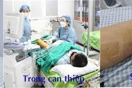 Suy giãn tĩnh mạch vì mỗi ngày đứng liên tục 8 – 12 giờ