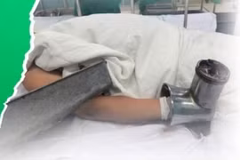 Mang cả bàn tay trong máy xay thịt đi cấp cứu