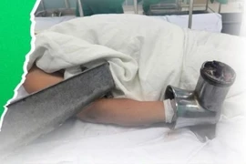 Mang cả bàn tay trong máy xay thịt đi cấp cứu