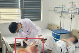 Chân hoại tử lan rộng vì đắp lá chữa bỏng