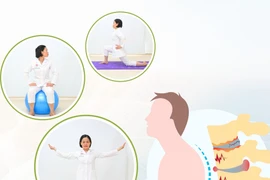 Tầm quan trọng của tập vận động đối với bệnh viêm cột sống dính khớp