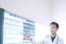 Người phụ nữ Hà Nội viêm phổi do 5 chủng vi khuẩn, virus và nấm khác nhau 