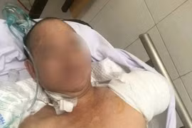 Hành trình giành giật sự sống cho bệnh nhân sốc nhiễm khuẩn nguy kịch do mụn