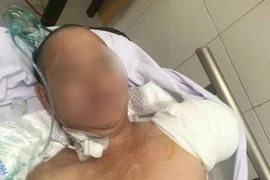 Hành trình giành giật sự sống cho bệnh nhân sốc nhiễm khuẩn nguy kịch do mụn