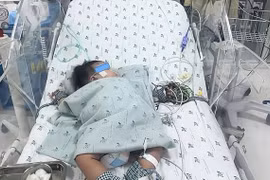 Bệnh nhi 4,5 tháng tuổi bị sốc sốt xuất huyết