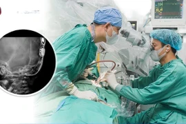 Cấy cực ốc tai, thắp sáng tương lai cho trẻ em khiếm thính