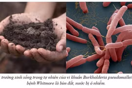 Cảnh báo vi khuẩn ăn thịt người giả dạng gia tăng đột biến sau mưa lũ