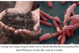 Cảnh báo vi khuẩn ăn thịt người giả dạng gia tăng đột biến sau mưa lũ