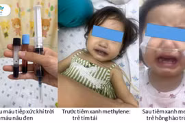 Ăn ghẹ, canh cải nấu với nước giếng, bé gái máu chuyển đen