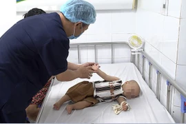 3000 trẻ khám tay chân miệng, bác sĩ chỉ rõ dấu hiệu trở nặng cần cấp cứu