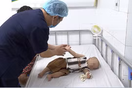 3000 trẻ khám tay chân miệng, bác sĩ chỉ rõ dấu hiệu trở nặng cần cấp cứu