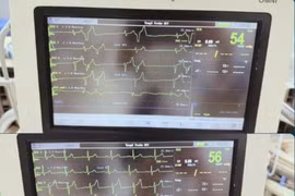 Lọc máu cứu sống cụ bà 88 tuổi rối loạn nhịp tim do tăng Kali máu