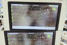 Lọc máu cứu sống cụ bà 88 tuổi rối loạn nhịp tim do tăng Kali máu