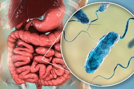 Bộ Y tế hướng dẫn người dân biện pháp phòng chống dịch bệnh tả