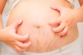 Những điều cần biết về nguyên nhân ngứa thường gặp ở phụ nữ mang thai