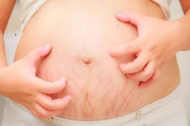 Những điều cần biết về nguyên nhân ngứa thường gặp ở phụ nữ mang thai