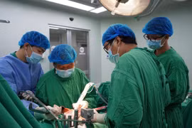 Cắt gan ung thư cho bệnh nhân bằng dao mổ siêu âm