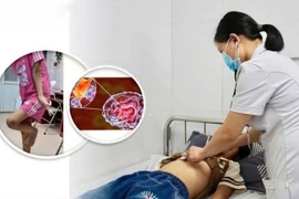 Trẻ 12 tuổi thay đổi hành vi không ngờ do viêm não tự miễn