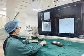 Nút mạch hóa chất điều trị ung thư gan kéo dài sự sống