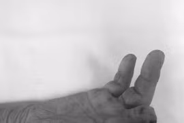 Người phụ nữ bị mất 2 ngón tay khi cắt rau bằng máy tại nhà