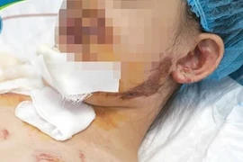 Gia tăng trẻ tai nạn dịp hè, nguy kịch tính mạng